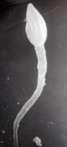 spermatozoïde (microscope électronique à balayage)