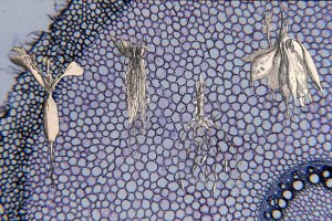 différents types de racines